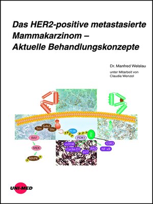 cover image of Das HER2-positive metastasierte Mammakarzinom – Aktuelle Behandlungskonzepte